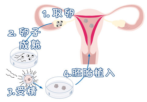 试管代怀公司